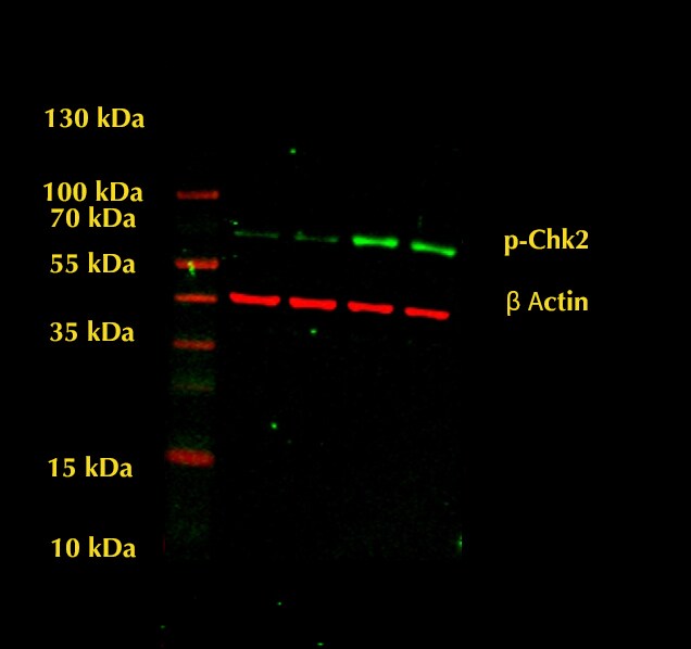 Human Chk2 Antibody MAB1358