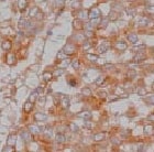 Human/Mouse alpha-Fetoprotein/AFP Antibody MAB1368