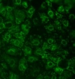 Human/Mouse alpha-Fetoprotein/AFP Antibody MAB1368