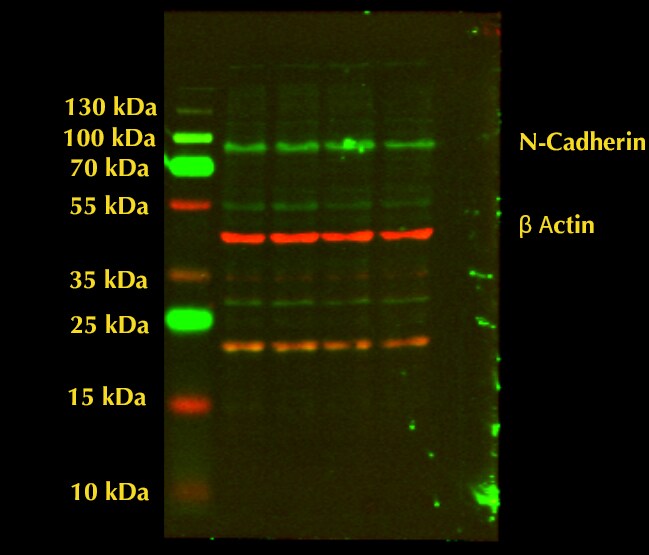 Human N‑Cadherin Antibody MAB13881
