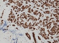 Human/Mouse DLL4 Antibody MAB1389