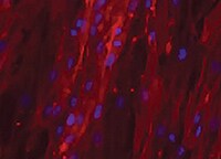Human/Rat Osteocalcin Antibody MAB1419