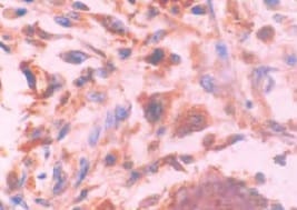Human/Rat Osteocalcin Antibody MAB1419