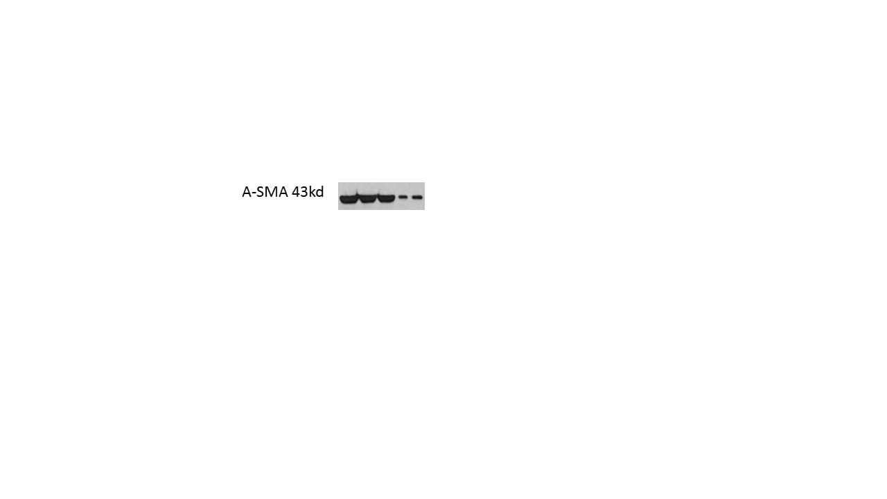 Human/Mouse/Rat  alpha ‑Smooth Muscle Actin Antibody MAB1420
