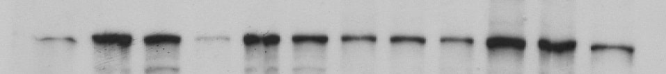 Human/Mouse/Rat  alpha ‑Smooth Muscle Actin Antibody MAB1420