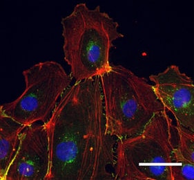 Human/Mouse/Rat  alpha ‑Smooth Muscle Actin Antibody MAB1420