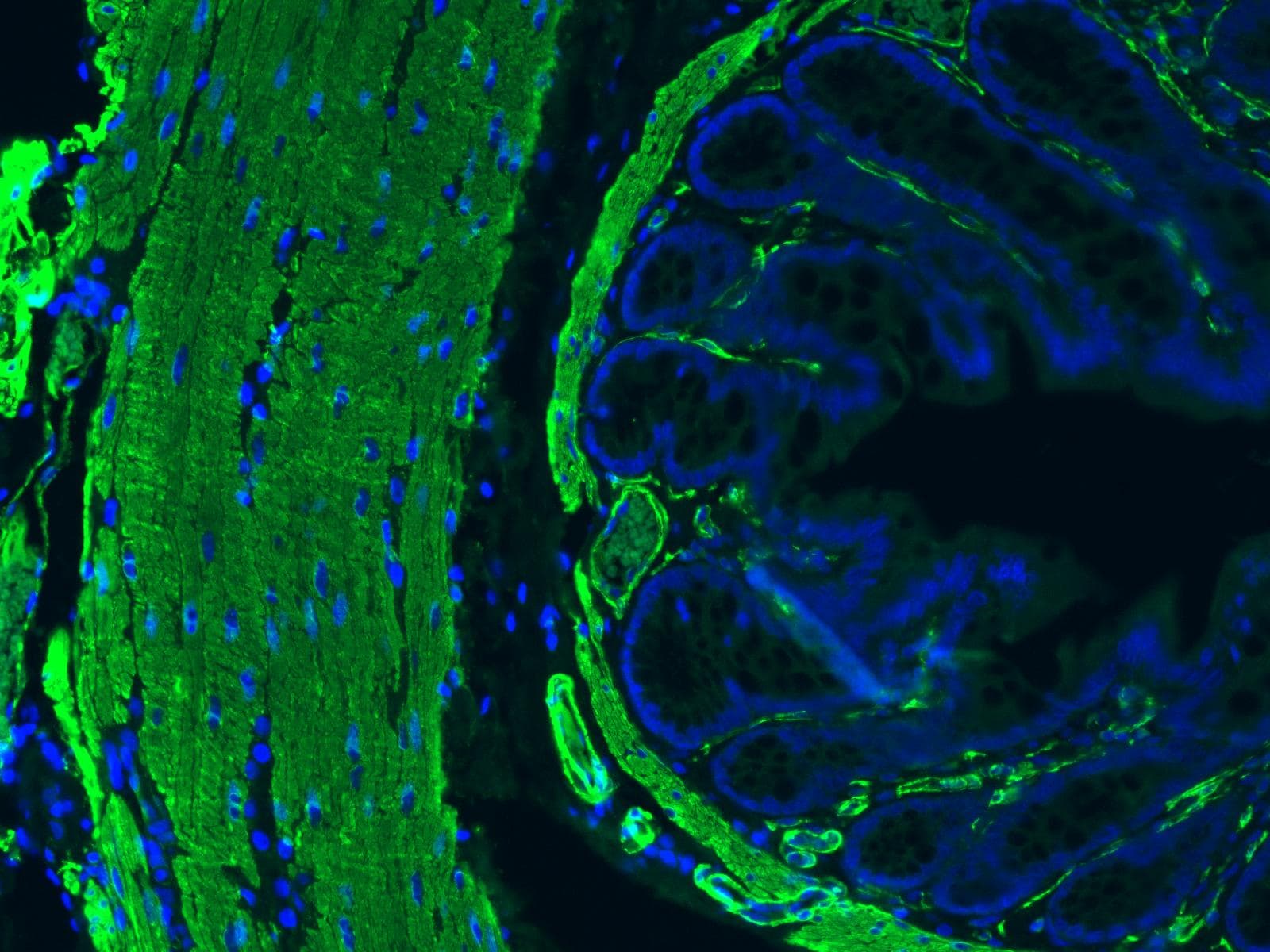 Human/Mouse/Rat  alpha ‑Smooth Muscle Actin Antibody MAB1420