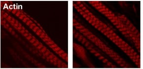 Human/Mouse/Rat  alpha ‑Smooth Muscle Actin Antibody MAB1420