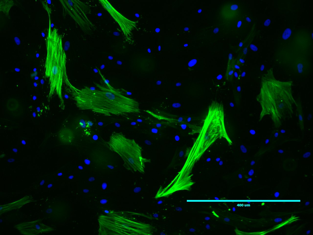 Human/Mouse/Rat  alpha ‑Smooth Muscle Actin Antibody MAB1420