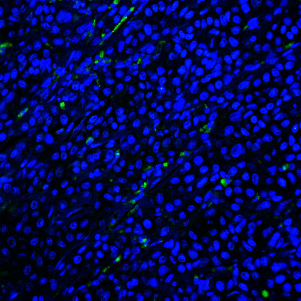 Human Osteopontin/OPN Antibody MAB1433