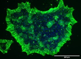 Human/Mouse SSEA‑3 Antibody MAB1434