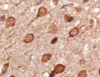 Human Parkin Antibody MAB14382