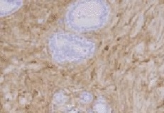 Human Decorin Antibody MAB143