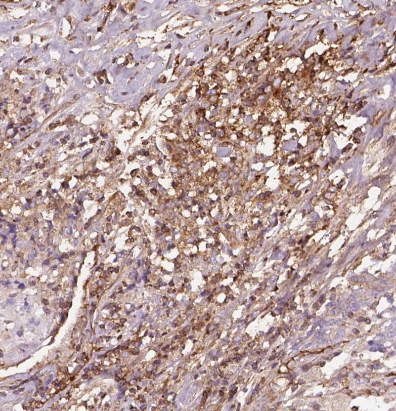 Human Decorin Antibody MAB143