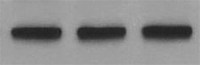 Mouse Angiopoietin-like 2 Antibody MAB1444