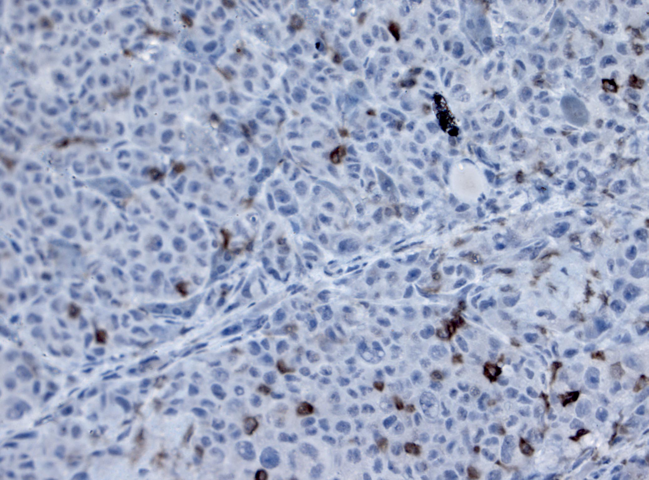 Human Alkaline Phosphatase/ALPL Antibody MAB1448