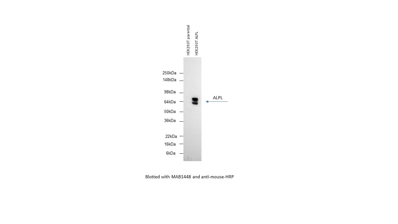 Human Alkaline Phosphatase/ALPL Antibody MAB1448