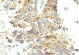 Human Alkaline Phosphatase/ALPL Antibody MAB1448