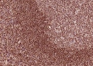 Human Serum Albumin Antibody MAB1455
