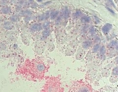 Human CCR2 Antibody MAB150