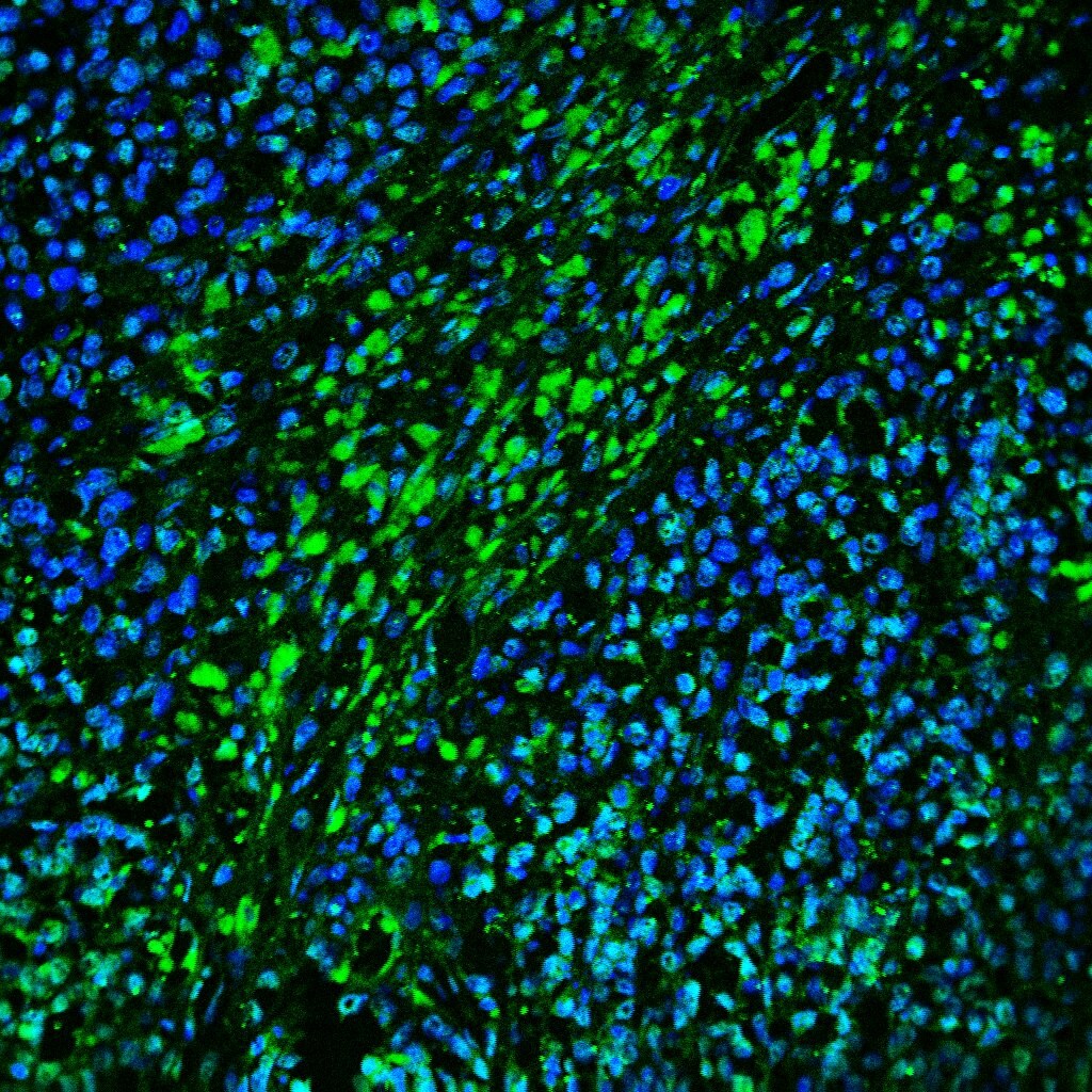 Human IL‑12/IL‑23 p40 Antibody MAB1510