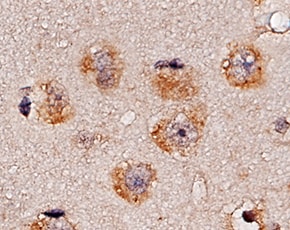 Human/Mouse/Rat HIF-1 alpha/HIF1A Antibody MAB1536