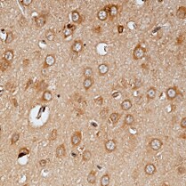 Mouse TRAIL R2/TNFRSF10B Antibody MAB1540