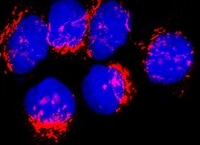 Human Insulin R/CD220 Antibody MAB1544