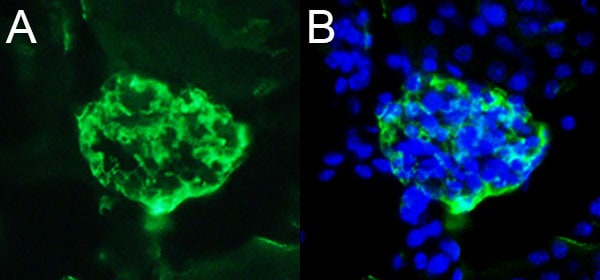 Mouse Podocalyxin Antibody MAB1556