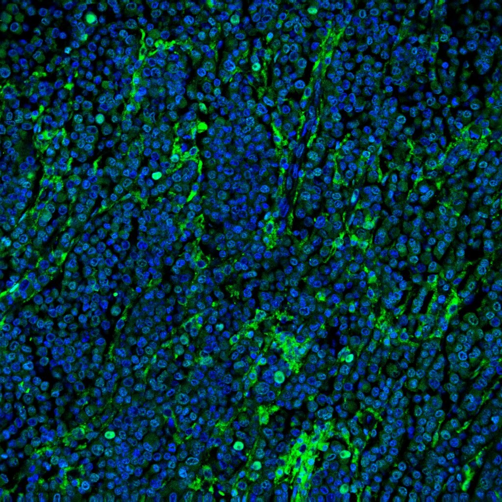 Human CCR3 Antibody MAB155