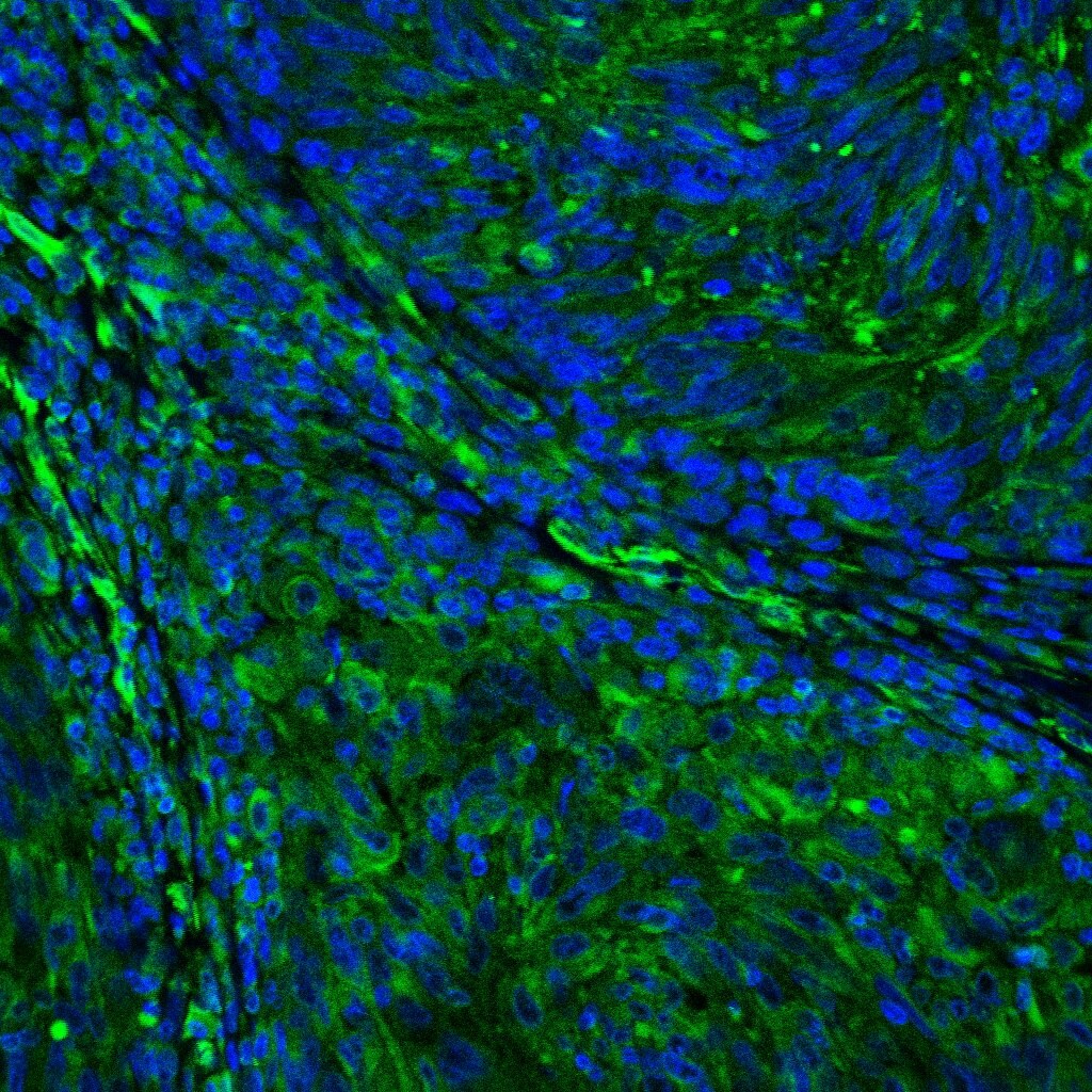 Human PD-L1/B7-H1 Antibody MAB1561