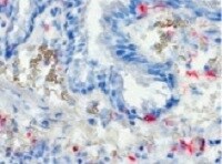 Human DC‑SIGN/CD209 Antibody MAB161