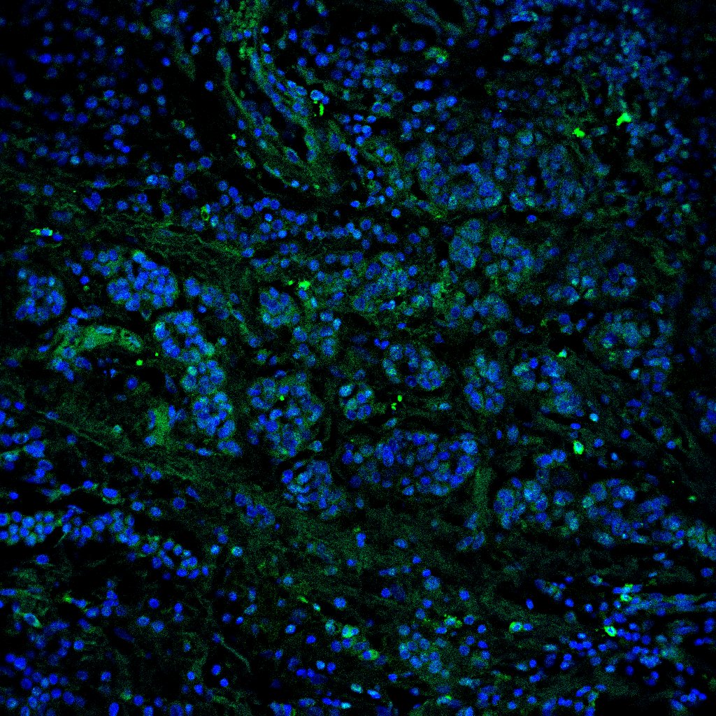 Human DC‑SIGN/CD209 Antibody MAB161