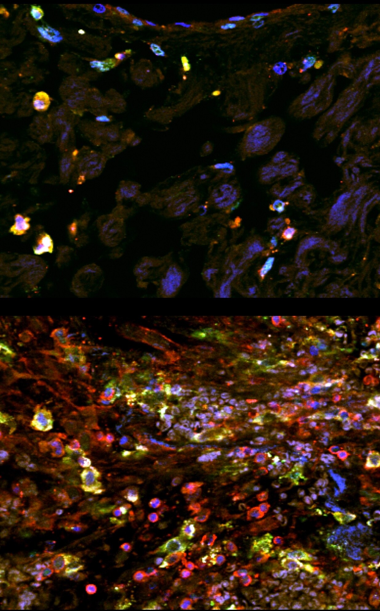 Human DC‑SIGN+DC‑SIGNR Antibody MAB1621