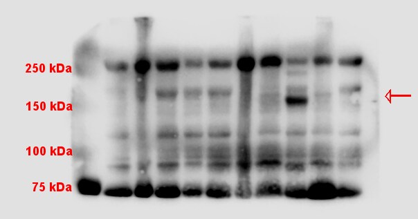 Human Thrombospondin‑2 Antibody MAB1635
