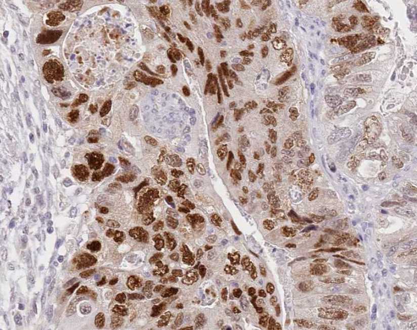 Human/Mouse/Rat CDC25A Antibody MAB1648