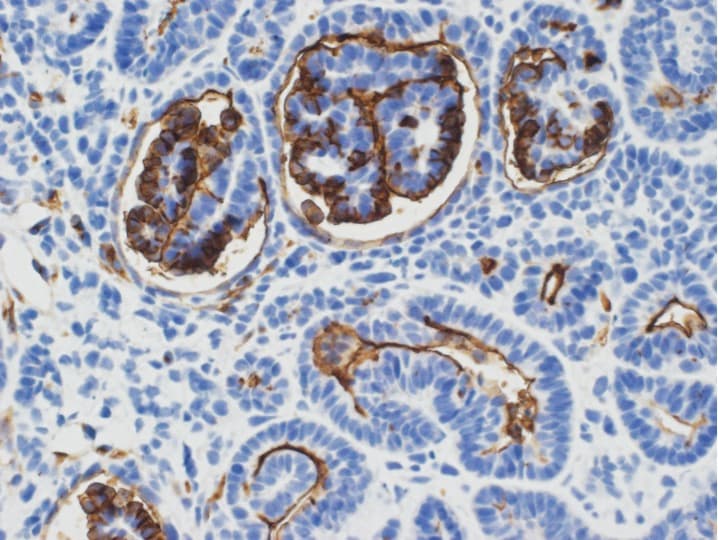 Human Podocalyxin Antibody MAB1658
