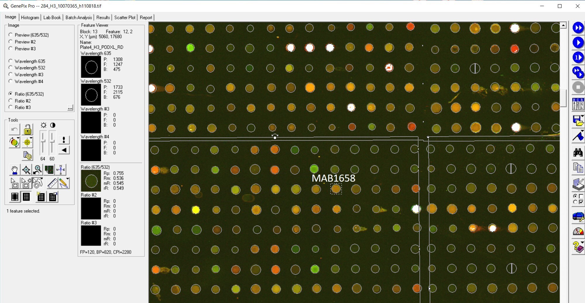 Human Podocalyxin Antibody MAB1658