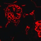 Human Podocalyxin Antibody MAB1658