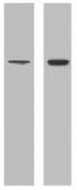Human CFTR R Domain Antibody MAB1660