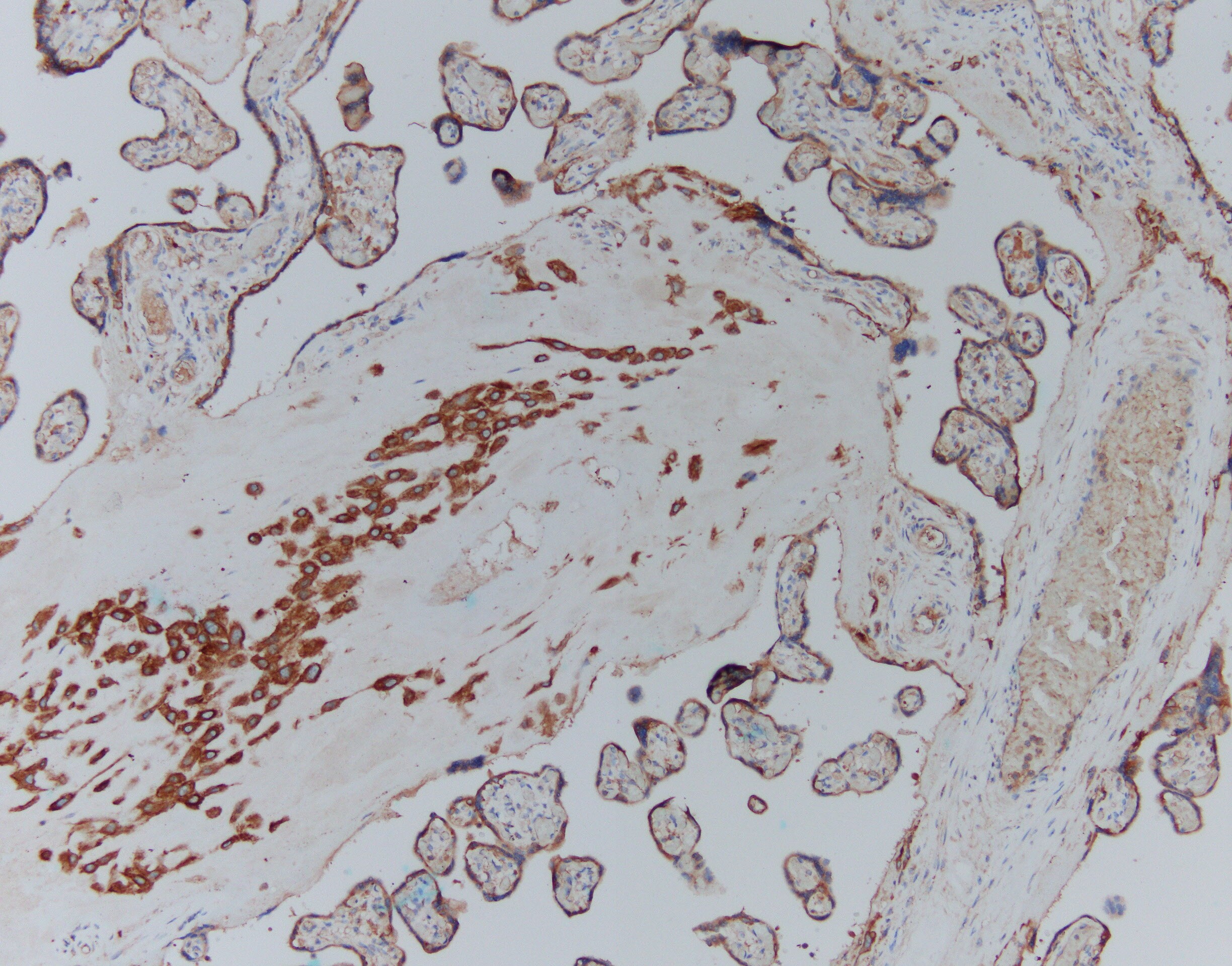 Human CFTR R Domain Antibody MAB1660