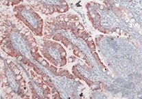 Human/Mouse/Rat FABP3/H‑FABP Antibody MAB1678