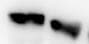 Human HMGB1/HMG‑1 Antibody MAB1690