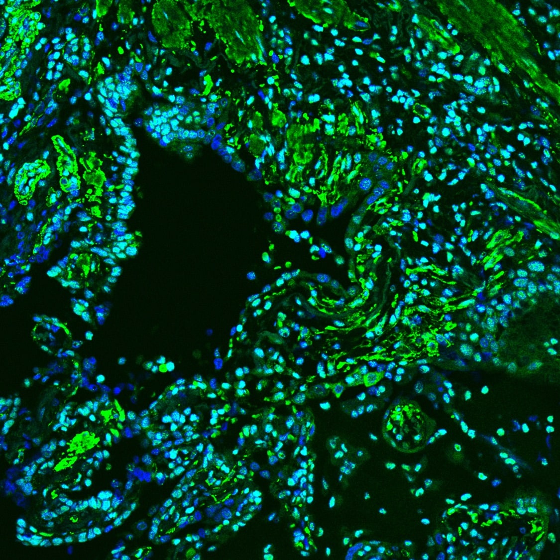 Human HMGB1/HMG‑1 Antibody MAB1690