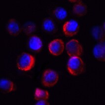 Human CD11b/Integrin alpha M Antibody MAB1699
