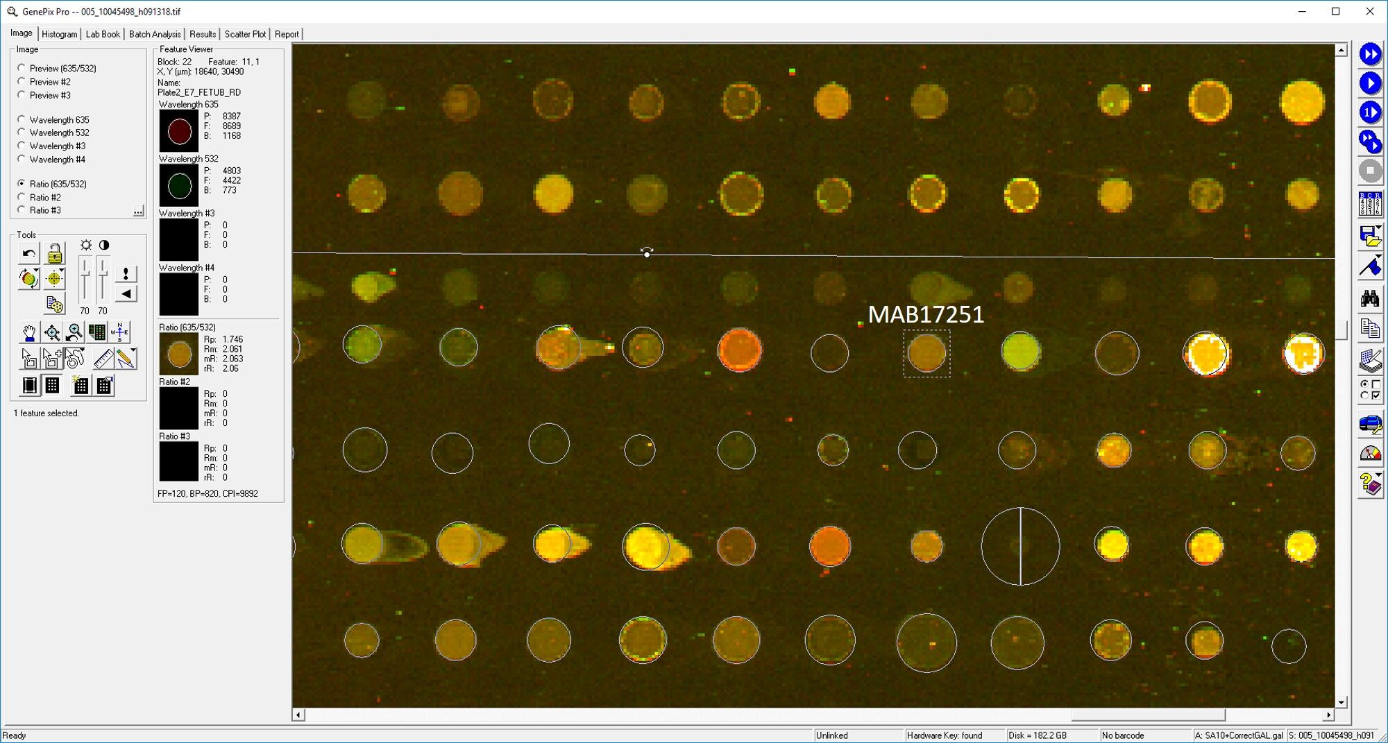 Human Fetuin B Antibody MAB17251