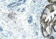 Human/Mouse Semaphorin 3C Antibody MAB1728