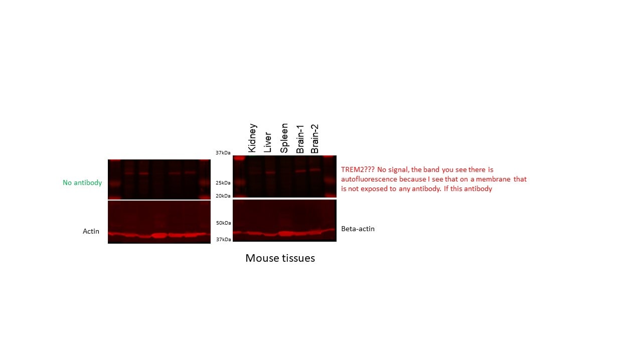 Mouse TREM2 Antibody MAB1729