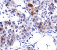 Human CXCR4 Antibody MAB172