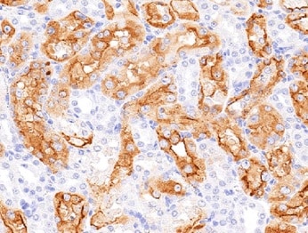 Human TIM‑1/KIM‑1/HAVCR Antibody MAB1750